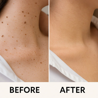 ClearSkin Pro