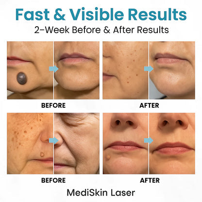 ClearSkin Pro
